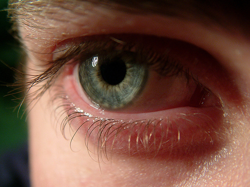 eye away